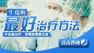 得了牛皮癣还能不能要孩子呢?