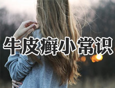 牛皮癣发作瘙痒难忍怎么办?.jpg