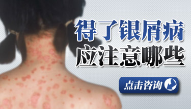 牛皮癣感染途径有哪些?