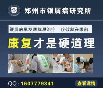 银屑病有哪些危害