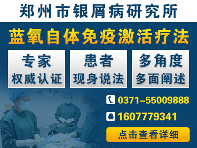 郑州市银屑病研究所怎么样