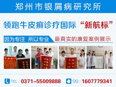 郑州银屑病研究所好吗