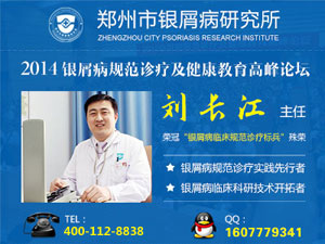 有什么方法治疗牛皮癣