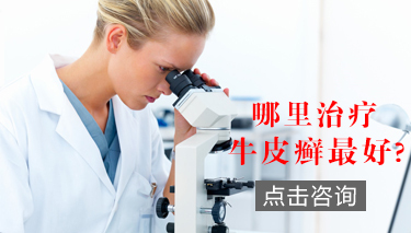 银屑病常见的症状