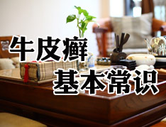 牛皮癣的具体特征表现有哪些