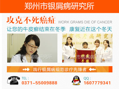 河南治疗银屑病的专科医院