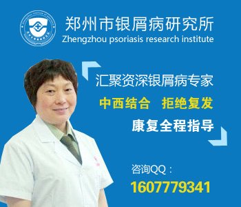 南阳市牛皮癣治疗医院