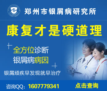 南阳市哪家医院治疗银屑病最好